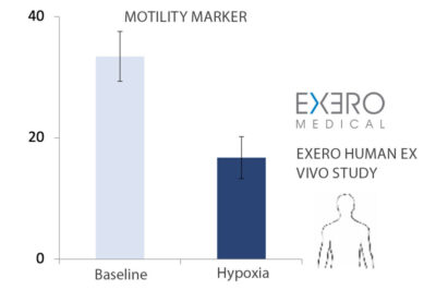 Graph - Exero Human ex vivo study