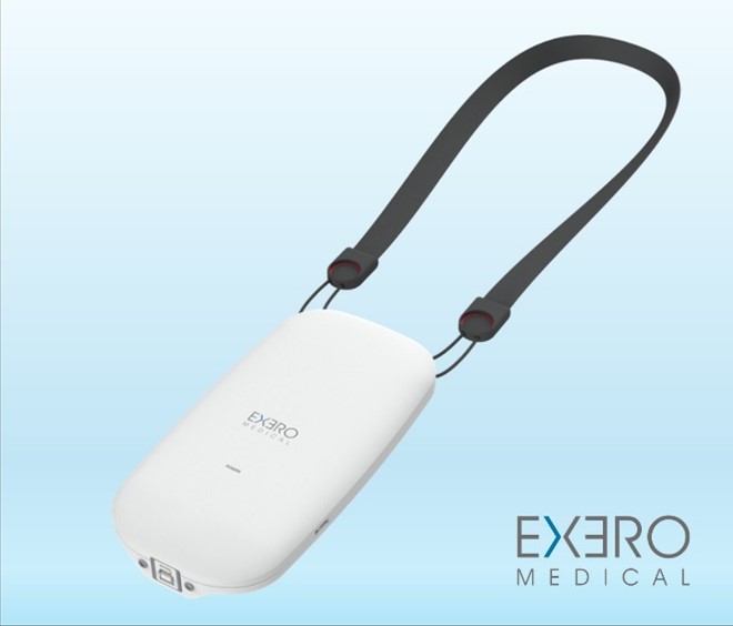 Exero’s xBar Device